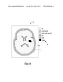 System And Method For Radio-Frequency Imaging, Registration, And     Localization diagram and image