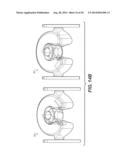 EXTREMITY IMAGING APPARATUS FOR CONE BEAM COMPUTED TOMOGRAPHY diagram and image