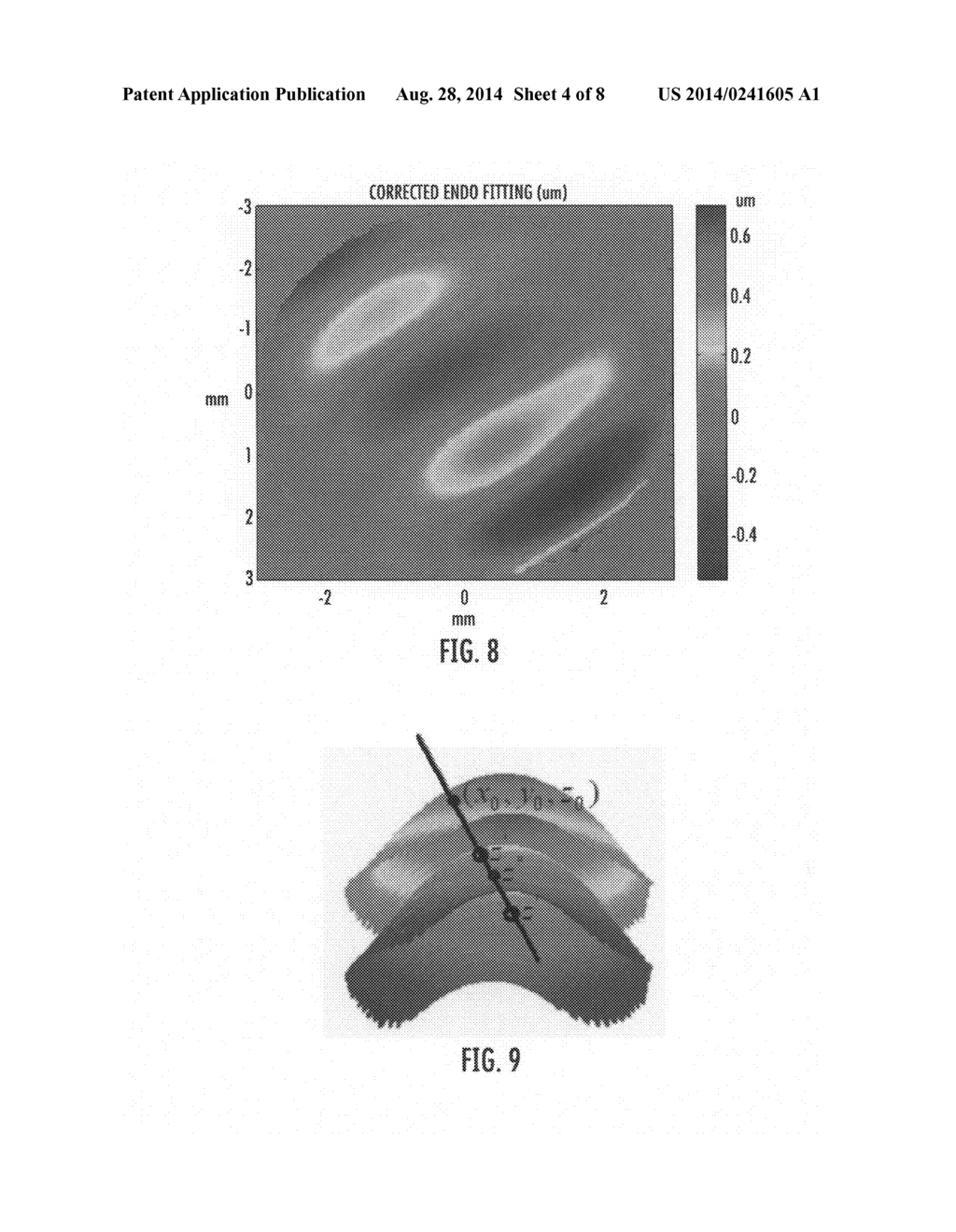 Methods and computer program products for quantitative three-dimensional     image correction and clinical parameter computation in optical coherence     tomography - diagram, schematic, and image 05