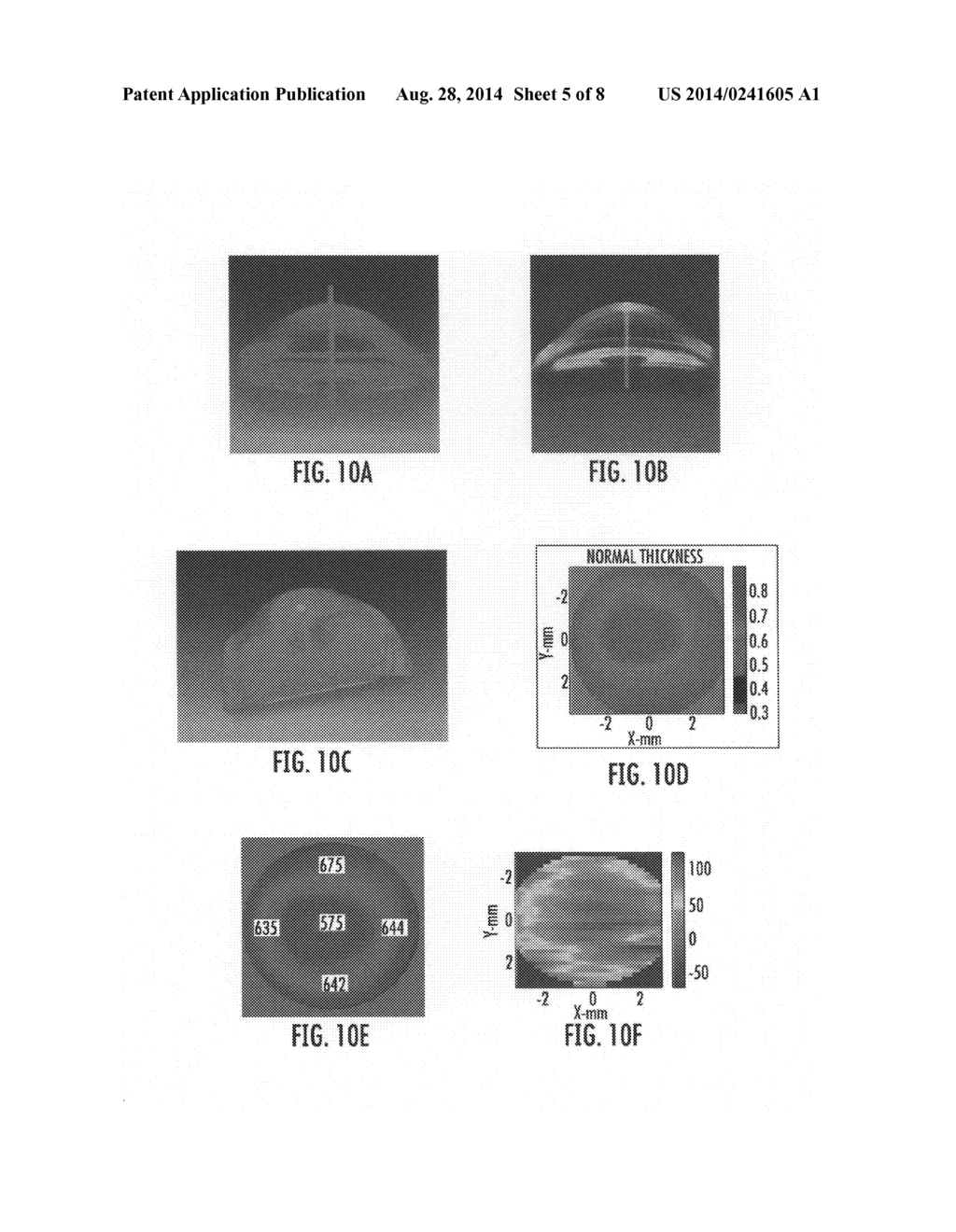 Methods and computer program products for quantitative three-dimensional     image correction and clinical parameter computation in optical coherence     tomography - diagram, schematic, and image 06