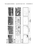 METHODS FOR TREATING UV-DAMAGED SKIN AND SCC TUMORS AND FOR REMOVING     TATTOOS WITH TOPICAL INGENOL MEBUTATE diagram and image