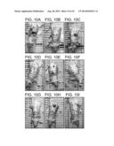 METHODS FOR TREATING UV-DAMAGED SKIN AND SCC TUMORS AND FOR REMOVING     TATTOOS WITH TOPICAL INGENOL MEBUTATE diagram and image