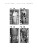 METHODS FOR TREATING UV-DAMAGED SKIN AND SCC TUMORS AND FOR REMOVING     TATTOOS WITH TOPICAL INGENOL MEBUTATE diagram and image