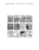 METHODS FOR TREATING UV-DAMAGED SKIN AND SCC TUMORS AND FOR REMOVING     TATTOOS WITH TOPICAL INGENOL MEBUTATE diagram and image