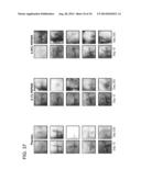 METHODS FOR TREATING UV-DAMAGED SKIN AND SCC TUMORS AND FOR REMOVING     TATTOOS WITH TOPICAL INGENOL MEBUTATE diagram and image