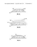 Hydrogel Implants with Varying Degrees of Crosslinking diagram and image