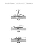 Hydrogel Implants with Varying Degrees of Crosslinking diagram and image