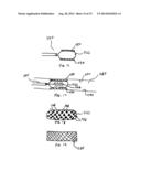 Hydrogel Implants with Varying Degrees of Crosslinking diagram and image