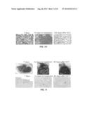 Tumor Vaccination in Combination with Hematopoietic Cell Transplantation     for Cancer Therapy diagram and image