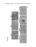 USE OF DEOXYELEPHANTOPIN (DET) AND ANALOGUES THEREOF FOR TREATMENT OF     MELANOMA diagram and image