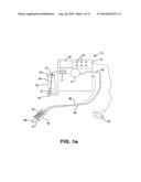 FEEDING SYSTEM FOR INFANTS diagram and image