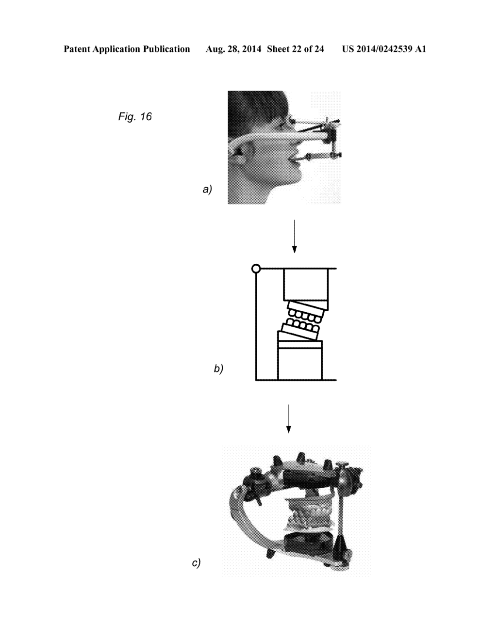 VIRTUAL DESIGN OF ATTACHMENT OF DENTAL MODEL IN ARTICULATOR - diagram, schematic, and image 23