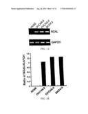 FREE NGAL AS A BIOMARKER FOR CANCER diagram and image