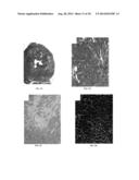 METHODS FOR IMPROVING CARDIAC CONTRACTILITY diagram and image