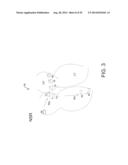 METHODS AND SYSTEM FOR REAL-TIME CARDIAC MAPPING diagram and image