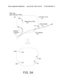 METHODS AND SYSTEM FOR REAL-TIME CARDIAC MAPPING diagram and image