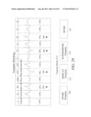 METHODS AND SYSTEM FOR REAL-TIME CARDIAC MAPPING diagram and image