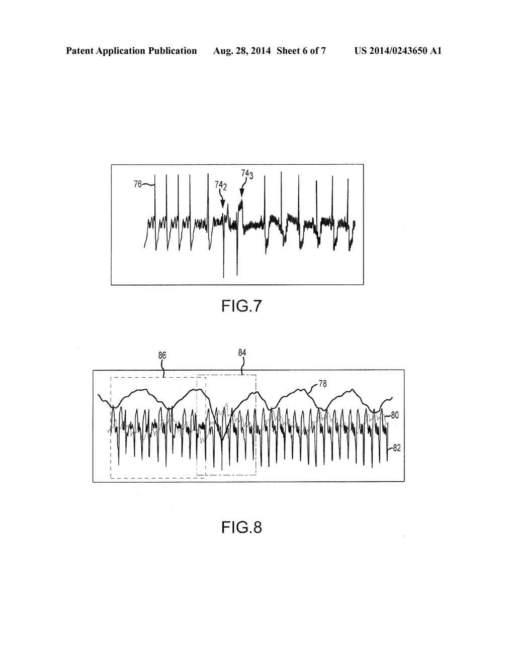 REPRESENTATIVE EMULATION OF ORGAN BEHAVIOR - diagram, schematic, and image 07