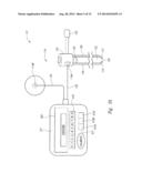 Method of Locating the Tip of a Central Venous Catheter diagram and image