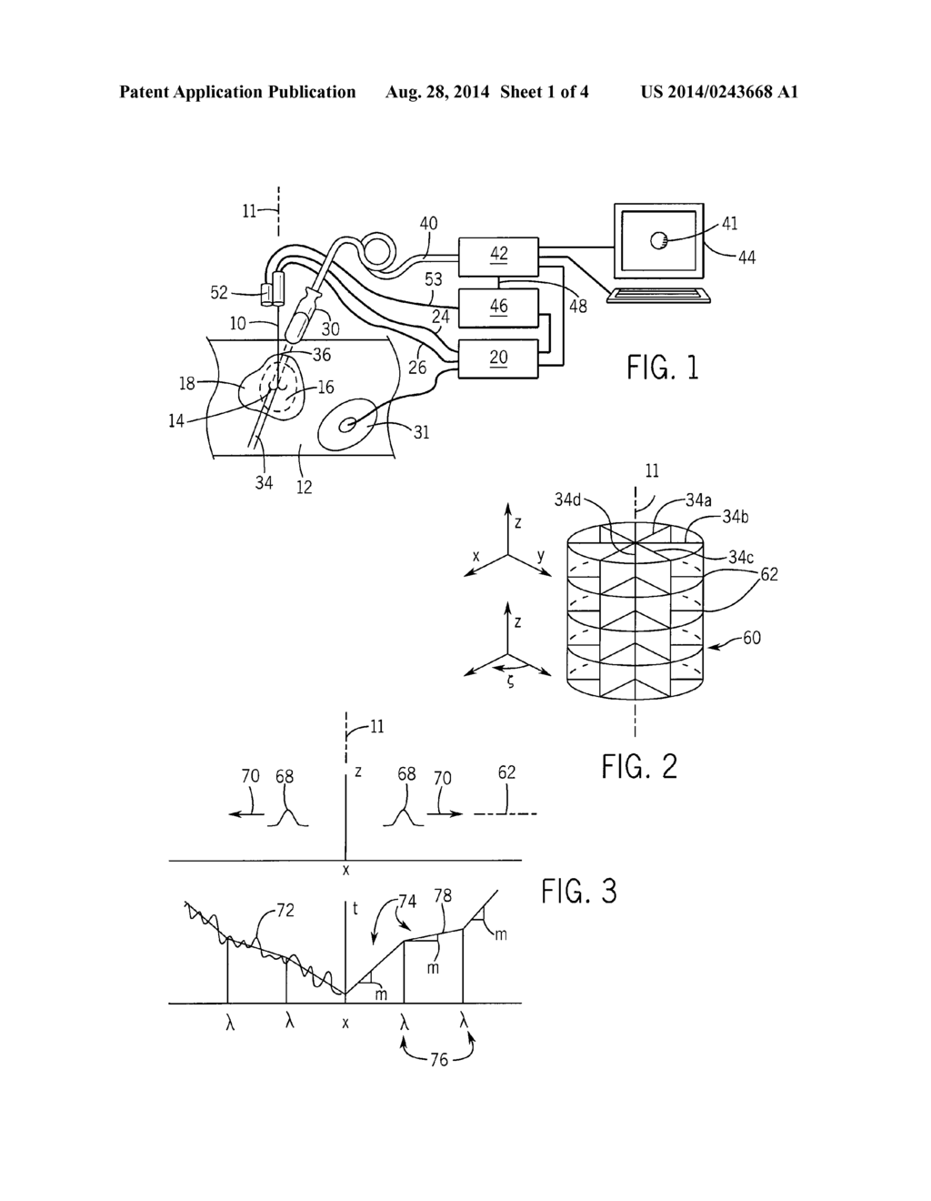 Method and Apparatus for Rapid Acquisition of Elasticity Data in Three     Dimensions - diagram, schematic, and image 02