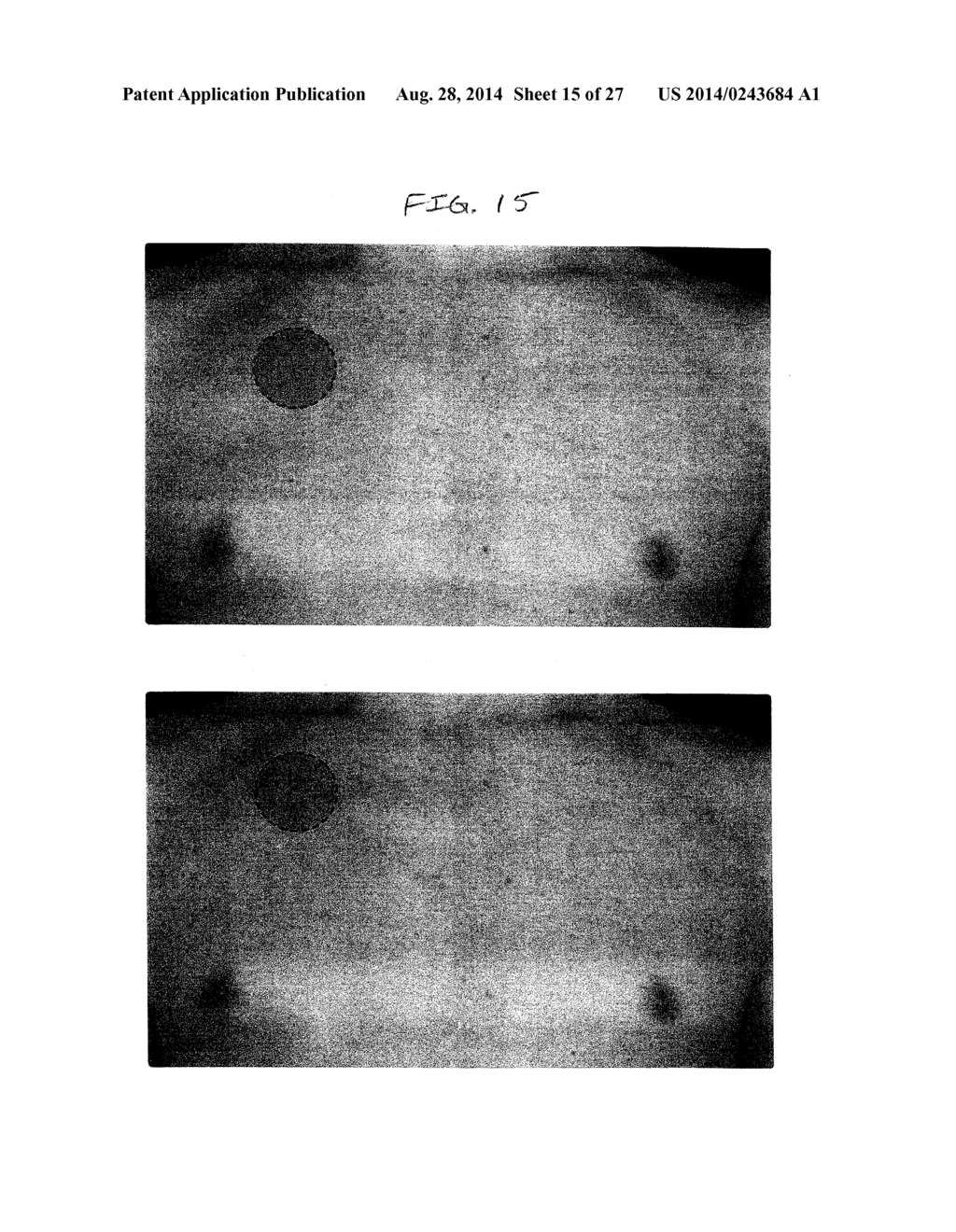 SYSTEM AND METHOD FOR CREATING, PROCESSING, AND DISPLAYING TOTAL BODY     IMAGE - diagram, schematic, and image 16