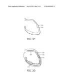 SHAPE SENSING DEVICES FOR REAL-TIME MECHANICAL FUNCTION ASSESSMENT OF AN     INTERNAL ORGAN diagram and image