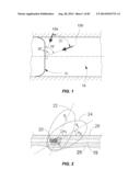 Extracorporeal Pressure Shock Wave Devices with Multiple Reflectors and     Methods for Using these Devices diagram and image