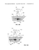 Extracorporeal Pressure Shock Wave Devices with Multiple Reflectors and     Methods for Using these Devices diagram and image