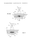 Extracorporeal Pressure Shock Wave Devices with Multiple Reflectors and     Methods for Using these Devices diagram and image