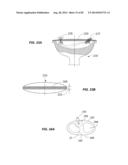 Extracorporeal Pressure Shock Wave Devices with Multiple Reflectors and     Methods for Using these Devices diagram and image