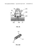 Extracorporeal Pressure Shock Wave Devices with Multiple Reflectors and     Methods for Using these Devices diagram and image