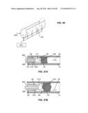 Extracorporeal Pressure Shock Wave Devices with Multiple Reflectors and     Methods for Using these Devices diagram and image