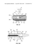 Extracorporeal Pressure Shock Wave Devices with Multiple Reflectors and     Methods for Using these Devices diagram and image