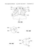 Extracorporeal Pressure Shock Wave Devices with Multiple Reflectors and     Methods for Using these Devices diagram and image