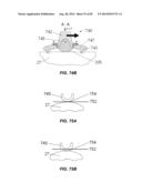 Extracorporeal Pressure Shock Wave Devices with Multiple Reflectors and     Methods for Using these Devices diagram and image