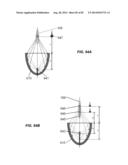 Extracorporeal Pressure Shock Wave Devices with Multiple Reflectors and     Methods for Using these Devices diagram and image