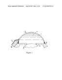 INTRAOCULAR SHUNT IMPLANTATION METHODS AND DEVICES diagram and image