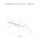 INTRAOCULAR SHUNT IMPLANTATION METHODS AND DEVICES diagram and image