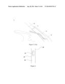 INTRAOCULAR SHUNT IMPLANTATION METHODS AND DEVICES diagram and image