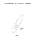 INTRAOCULAR SHUNT IMPLANTATION METHODS AND DEVICES diagram and image