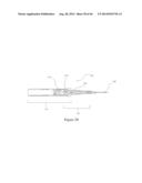 INTRAOCULAR SHUNT IMPLANTATION METHODS AND DEVICES diagram and image