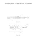 INTRAOCULAR SHUNT IMPLANTATION METHODS AND DEVICES diagram and image