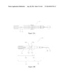 INTRAOCULAR SHUNT IMPLANTATION METHODS AND DEVICES diagram and image