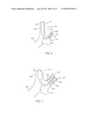 APPARATUS AND METHODS FOR ACCESSING THE LYMPHATIC SYSTEM diagram and image