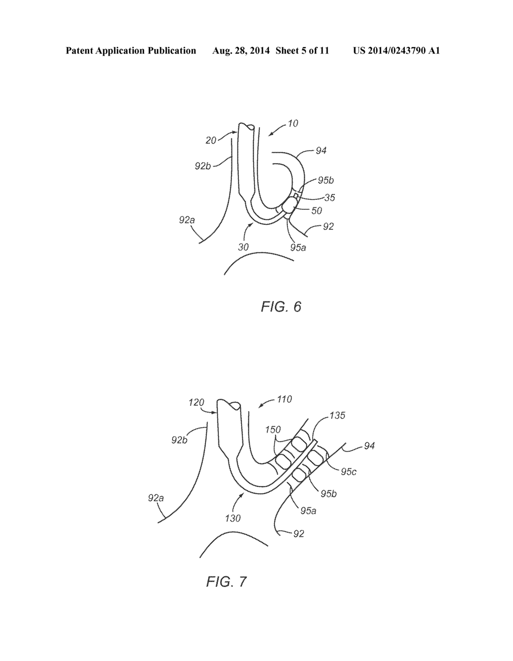 APPARATUS AND METHODS FOR ACCESSING THE LYMPHATIC SYSTEM - diagram, schematic, and image 06