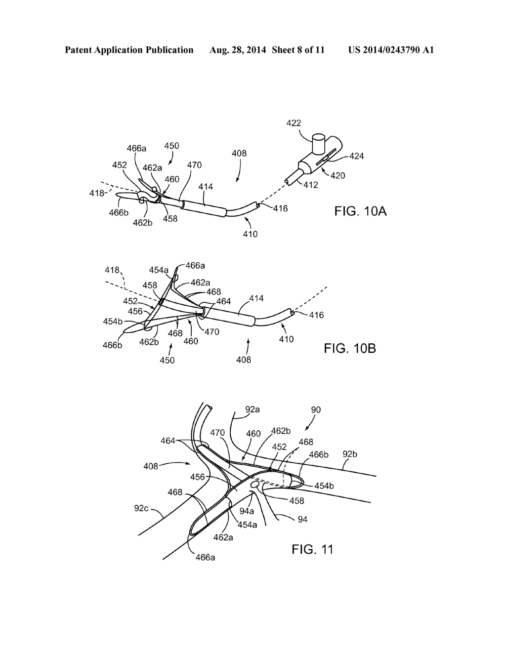 APPARATUS AND METHODS FOR ACCESSING THE LYMPHATIC SYSTEM - diagram, schematic, and image 09