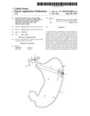 CATHETER STRUCTURE AND METHOD FOR LOCATING TISSUE IN A BODY ORGAN AND     SIMULTANEOUSLY DELIVERING THERAPY AND EVALUATING THE THERAPY DELIVERED diagram and image