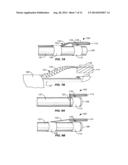 AUTO-ALIGNING ABLATING DEVICE AND METHOD OF USE diagram and image