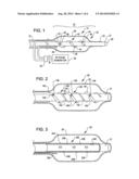 SHOCK WAVE BALLOON CATHETER WITH MULTIPLE SHOCK WAVE SOURCES diagram and image