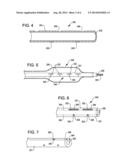 SHOCK WAVE BALLOON CATHETER WITH MULTIPLE SHOCK WAVE SOURCES diagram and image